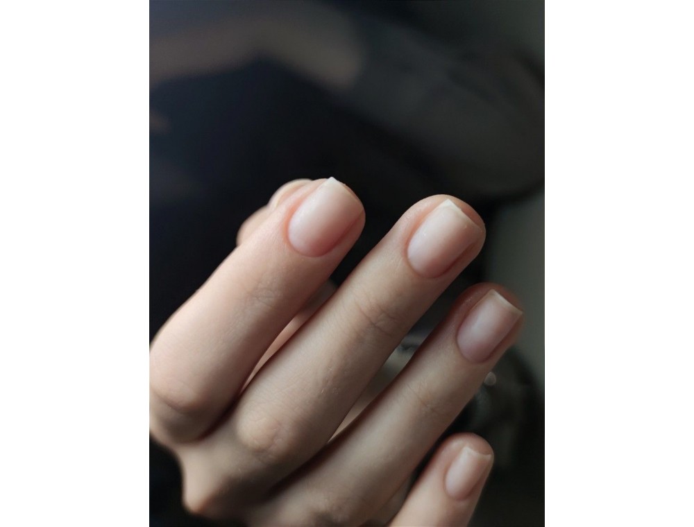 What to do about brittle and weak nails: tips for care and nutrition