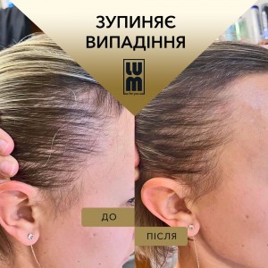 Коктейль для росту волосся LUM - Cocktail for hair №1