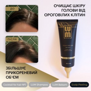 LUM kit "Control of greasiness of the scalp" (Shampoo + Balm + Cocktail for hair growth + Peeling for the scalp)