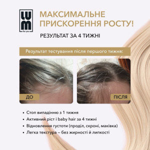 Набір LUM «КУРС 90 ДНІВ: АКТИВАЦІЯ ФОЛІКУЛІВ ТА ПОЯВА ГУСТИНИ»