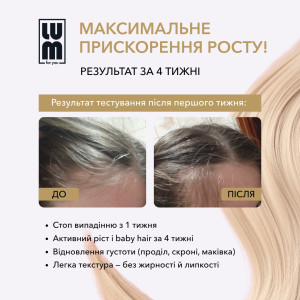 LUM HAIR LOTION IS A LOTION FOR ACCELERATING HAIR GROWTH