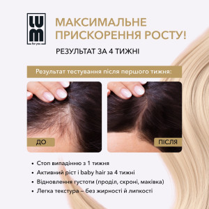 LUM HAIR LOTION IS A LOTION FOR ACCELERATING HAIR GROWTH