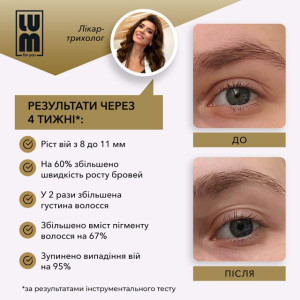 БОКС ЛЮТОГО LUM